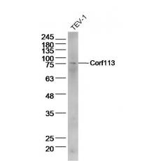 Anti-C1orf113 antibody