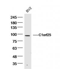 Anti-C1orf25 antibody