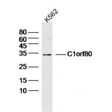 Anti-C1orf80 antibody