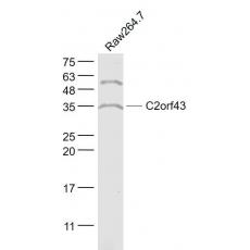 Anti-C2orf43 antibody