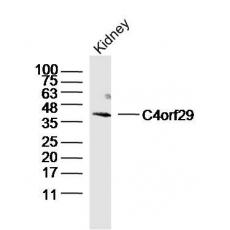 Anti-C4orf29 antibody