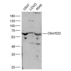 Anti-C6orf222 antibody