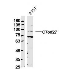 Anti-C7orf27 antibody