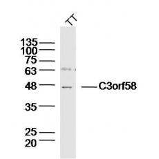 Anti-C3orf58 antibody