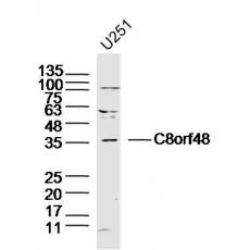 Anti-C8orf48 antibody