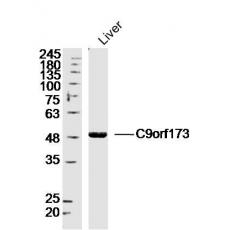Anti-C9orf173 antibody