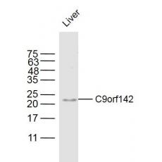 Anti-C9orf142 antibody