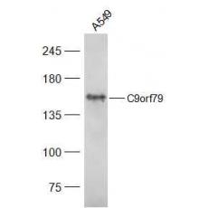 Anti-C9orf79 antibody