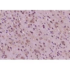 Anti-Calcitonin antibody