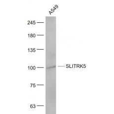 Anti-SLITRK5 antibody