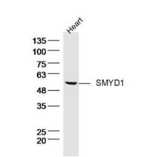 Anti-SMYD1 antibody