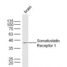 Anti-Somatostatin Receptor 1 antibody