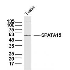 Anti-SPATA15/SPATC1 antibody