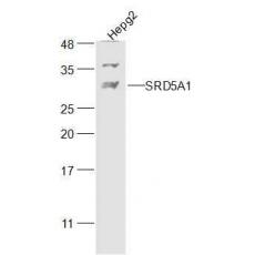 Anti-SRD5A1 antibody