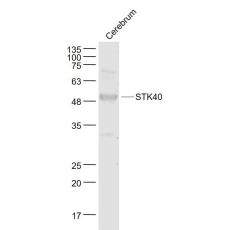 Anti-STK40 antibody