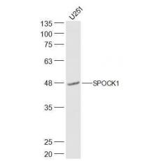 Anti-SPOCK1 antibody