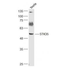 Anti-STK35 antibody