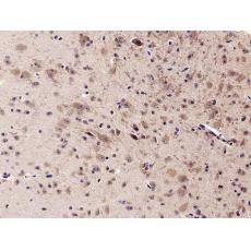 Anti-Synaptopodin antibody