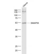 Anti-TBL1X/SMAP55 antibody