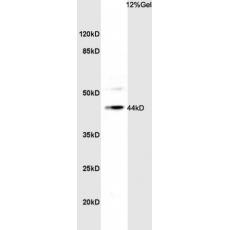 Anti-TBX1 antibody