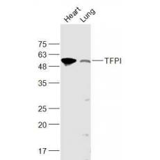 Anti-TFPI antibody