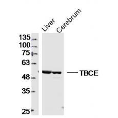 Anti-TBCE antibody