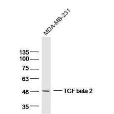 Anti-TGF beta 2 antibody