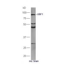 Anti-UBF1 antibody