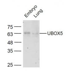 Anti-UBOX5 antibody