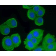 Anti-GRP94 antibody