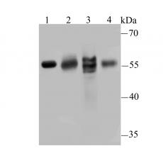 Anti-IL17RB antibody