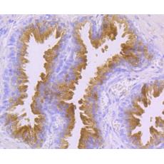 Anti-Prostate-Specific Antigen (PSA) antibody