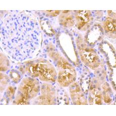 Anti-TNFAIP3 antibody