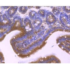 Anti-PP2C alpha antibody