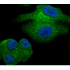 Anti-GOLPH3 antibody