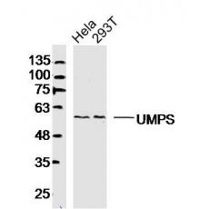 Anti-UMPS antibody