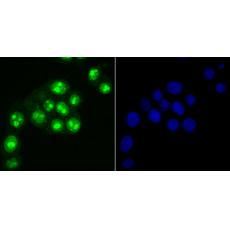 Anti-Ki67 antibody