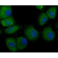 Anti-TLR4 antibody