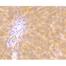 Anti-JAK2 antibody