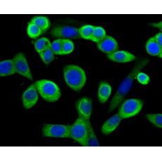 Anti-MMP-3 antibody