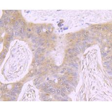 Anti-ATP citrate lyase antibody