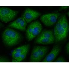 Anti-CXCR4 antibody