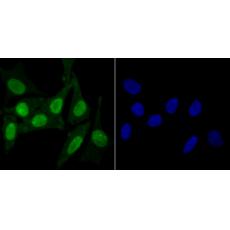 Anti-KDM5B antibody