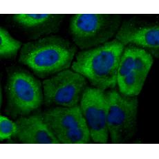 Anti-Mitofusin 2 antibody