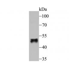 Anti-FOXF2 antibody