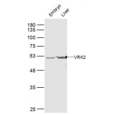 Anti-VRK2 antibody