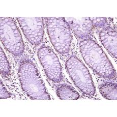 Anti-WWOX antibody