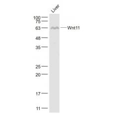 Anti-Wnt11 antibody