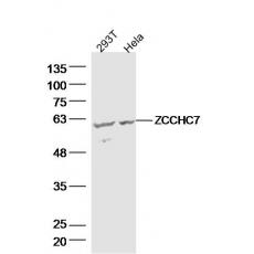 Anti-ZCCHC7 antibody