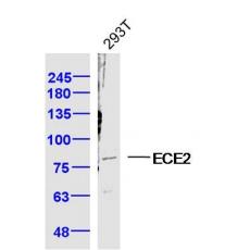 Anti-ECE2 antibody